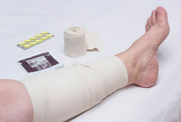 conséquences possibles après la chirurgie